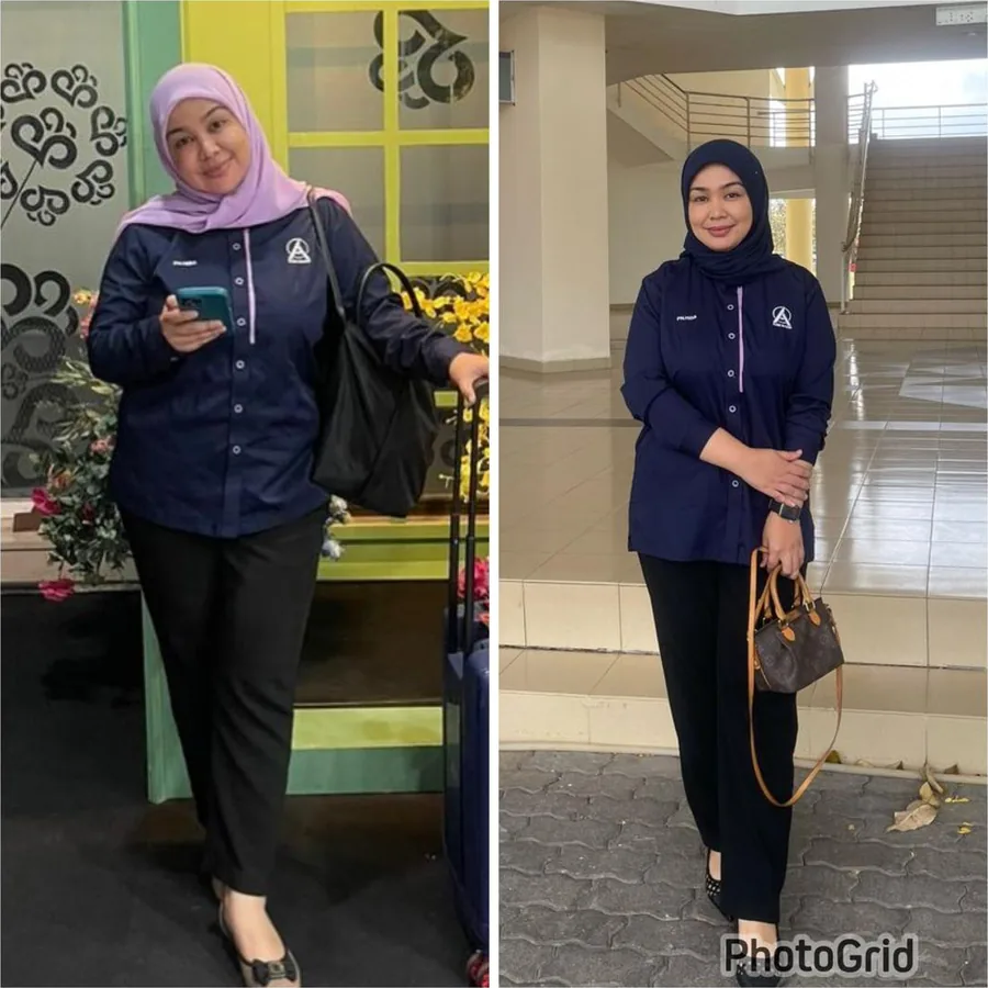 Mdm Hida, isteri Dr. Azrin, berbaju kerja sama, sebelum dan selepas